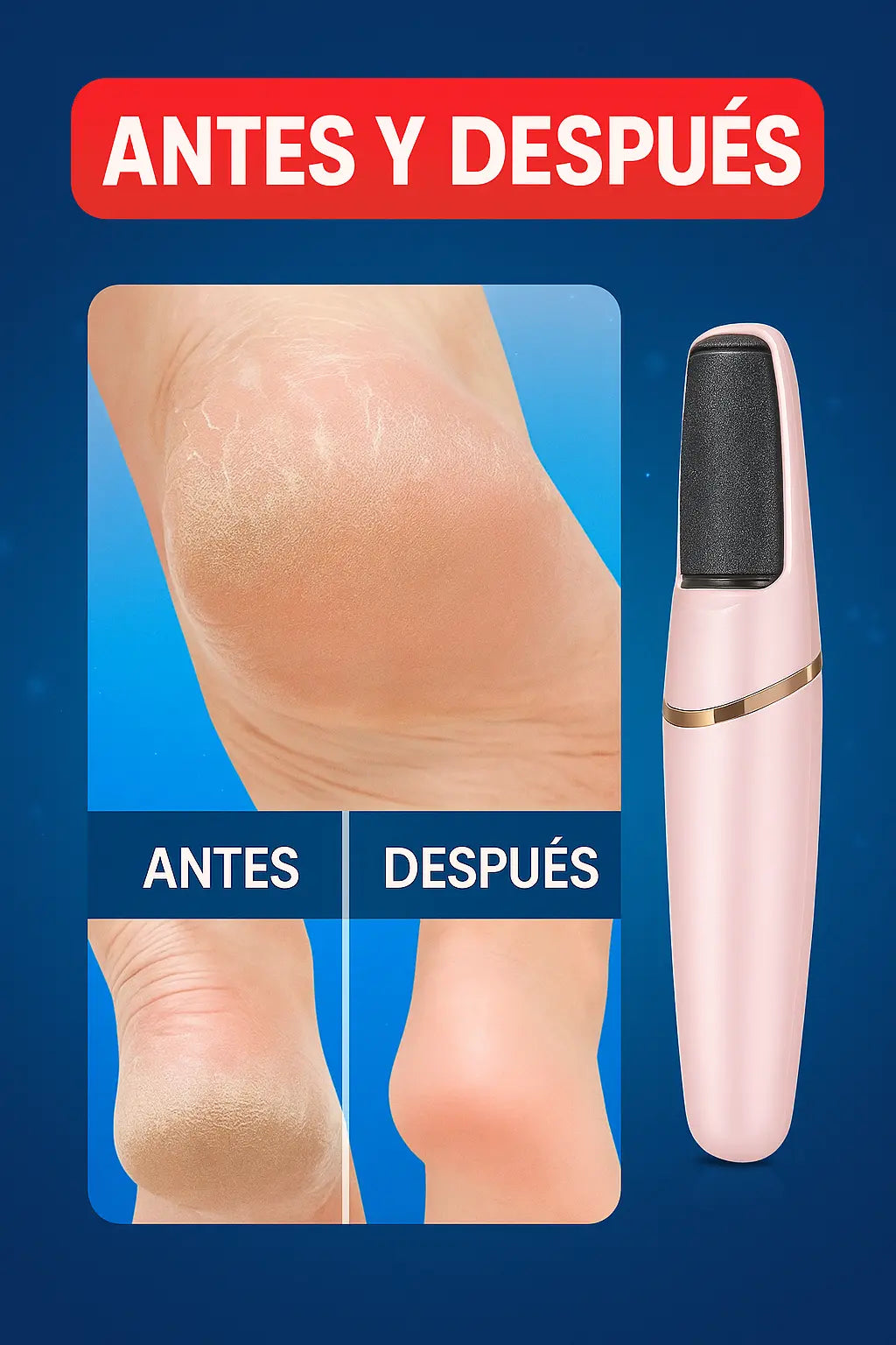 Removedor de Callos Eléctrico + Cabezal Adicional de Regalo + Guía Digital GRATIS!