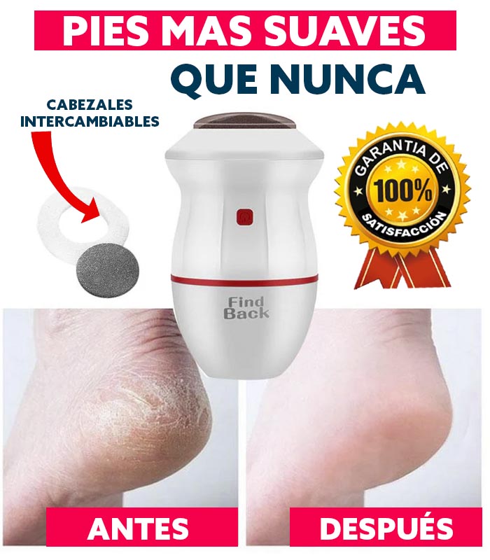 Removedor de Callos + REGALO Guía Digital "Pies en Armonía"