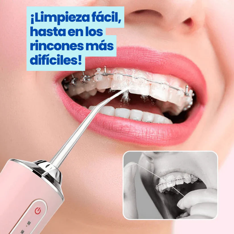 🦷Irrigador Bucal Recargable USB | Limpieza Rápida y Efectiva