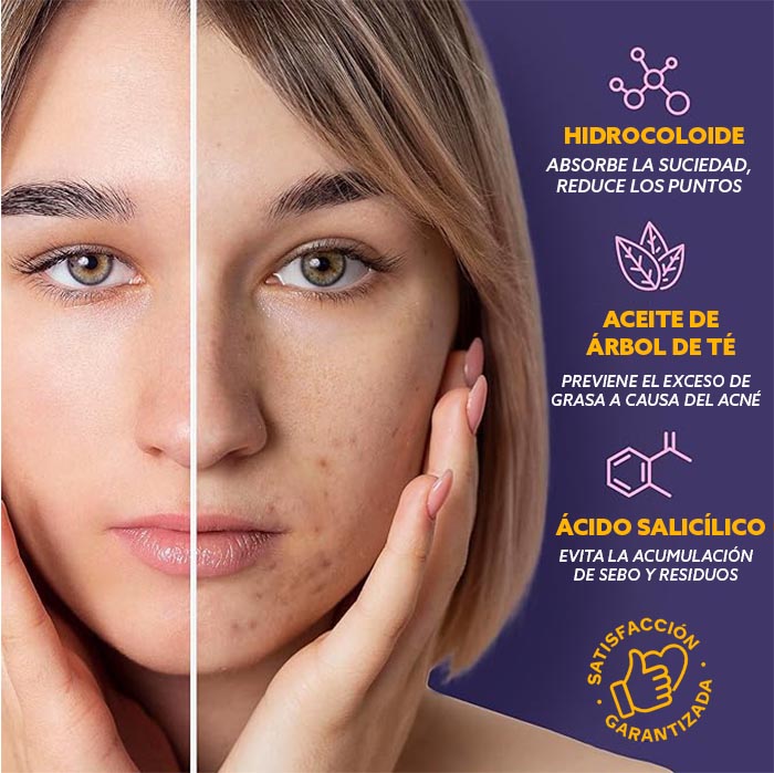 StarGlow® Set de Parches Anti-Acné | 🎁PAGA 1 LLEVA 2🎁